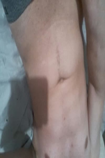 Eder